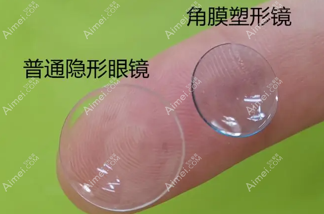 12岁有必要佩戴角膜塑形镜改善近视
