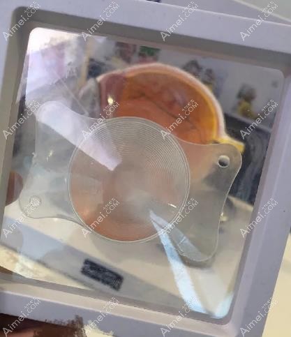 三焦点人工晶体多少钱 三焦点人工晶体多少钱