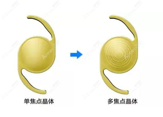 美国强生眼力健人工晶体zma00价格