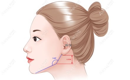 重庆松山医院磨骨水平高