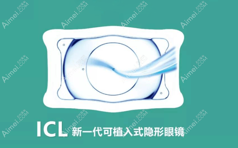 上海icl晶体植入价格1.68w起(单眼),icl晶体近视眼手术可靠且移位概率低