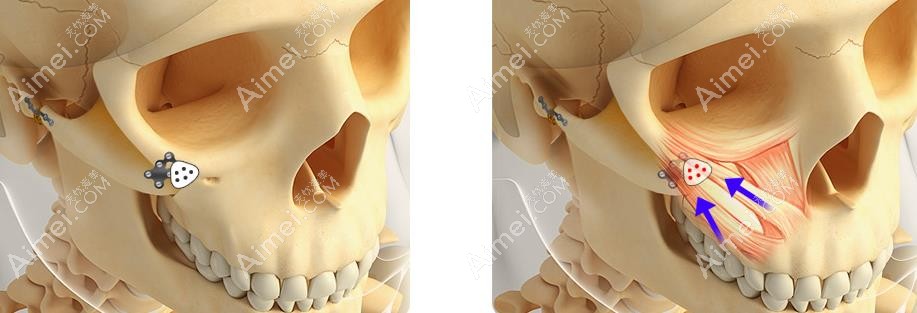 景熙翔在韩国口碑好