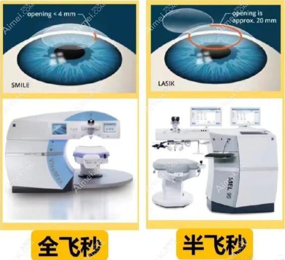 惠州希玛林顺潮眼科做近视手术价格