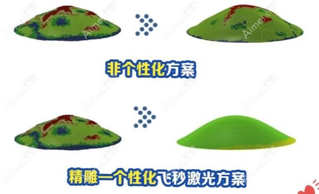 精diao綠飛秒手術(shù)原理