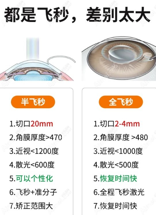 全飞秒和半飞秒区别m.a&imei.com