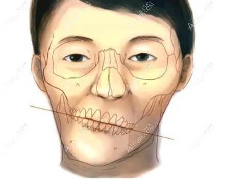 重庆松山医院偏颌矫正价格