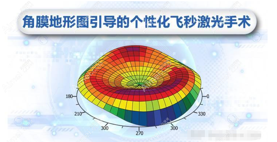 上海个性化半飞秒手术价格