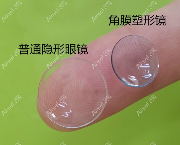 日戴维rgp角膜塑形镜