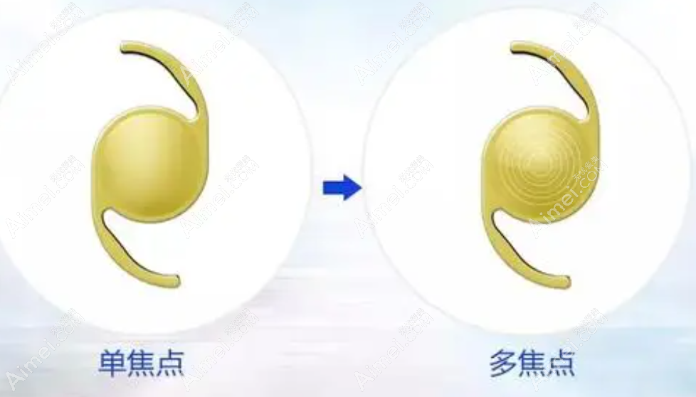 10000多的白内障晶体是中高端晶体水平