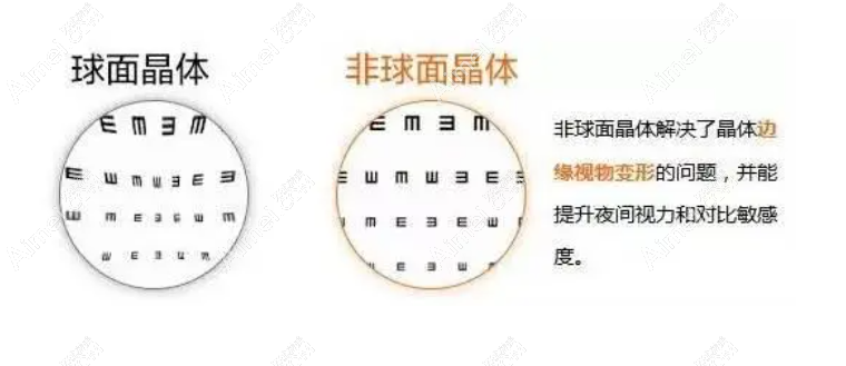 白内障球面晶体和非球面晶体区别