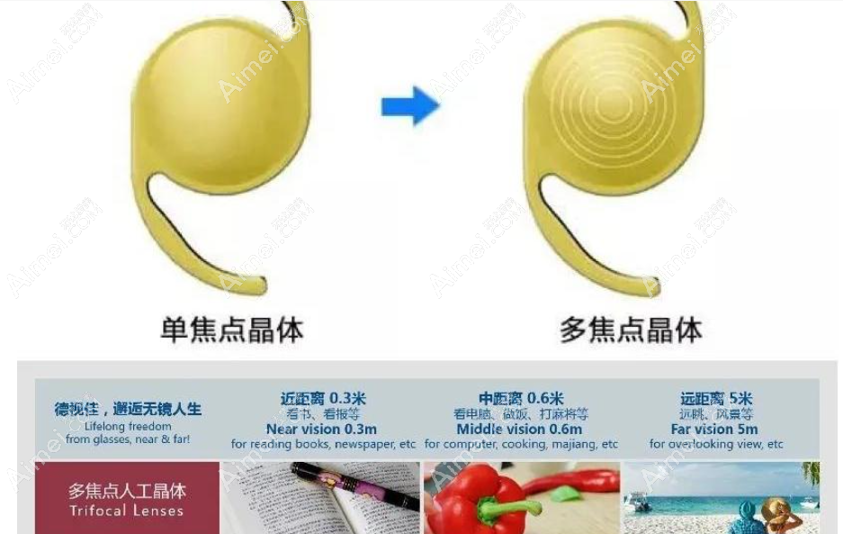白内障晶体3000的好吗