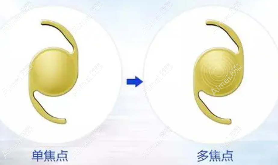 上海老人白内障手术费用和方法