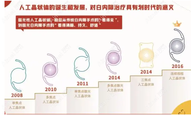 上海白内障手术价格