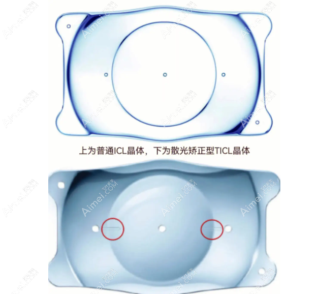 福州icl晶体植入价格一览表