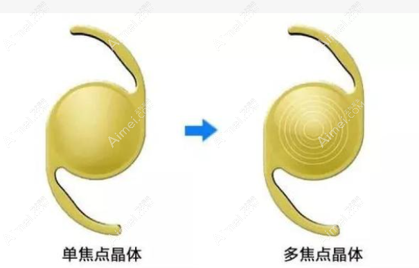 老年人换晶体不建议使用双焦点晶体和三焦点人工晶体