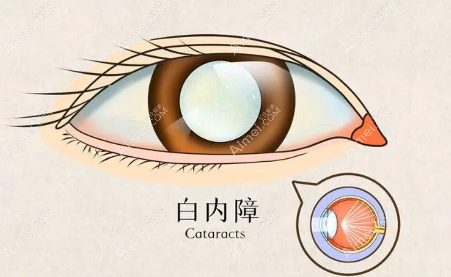 临沂华厦眼科医院是正规医院