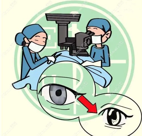 聊城华厦眼科任春慧医生技术好aimei.com 聊城华厦眼科任春慧医生技术好aimei.com