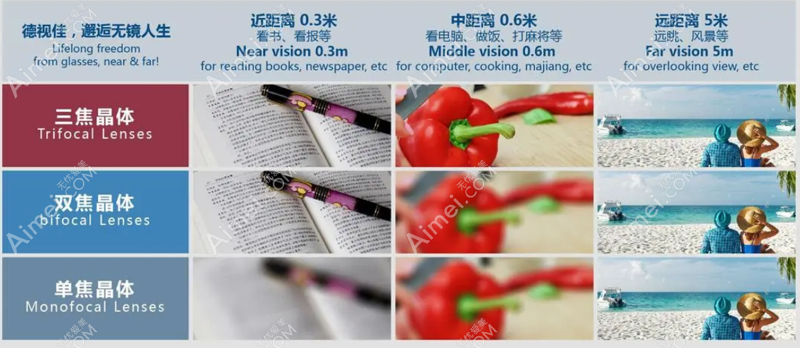 全视觉三焦点人工晶体远中近都看得清