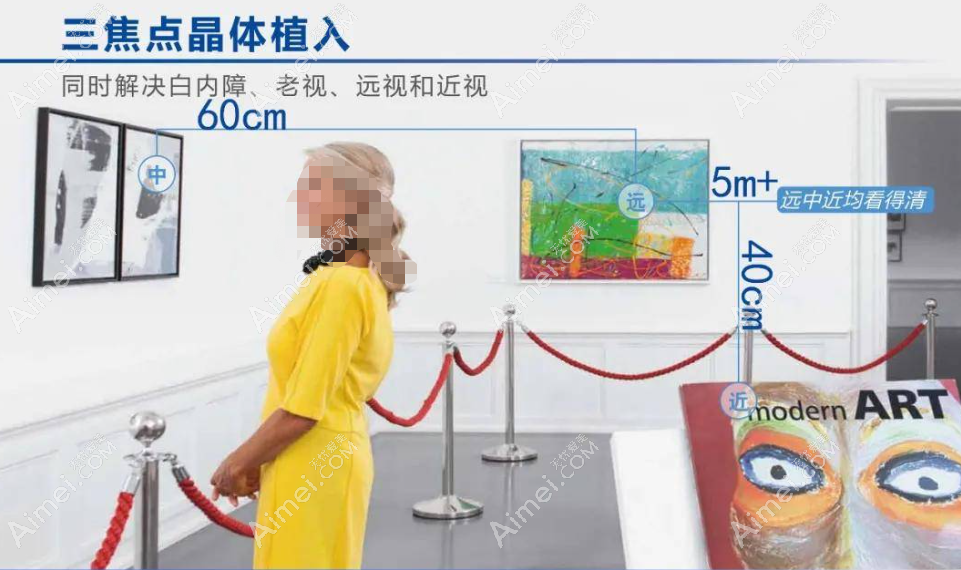 全视觉三焦点人工晶体怎么样