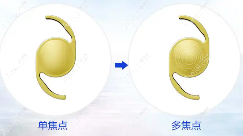 美国博士伦人工晶体价格及型号:博士伦Akreos/mx60型号价格3000+