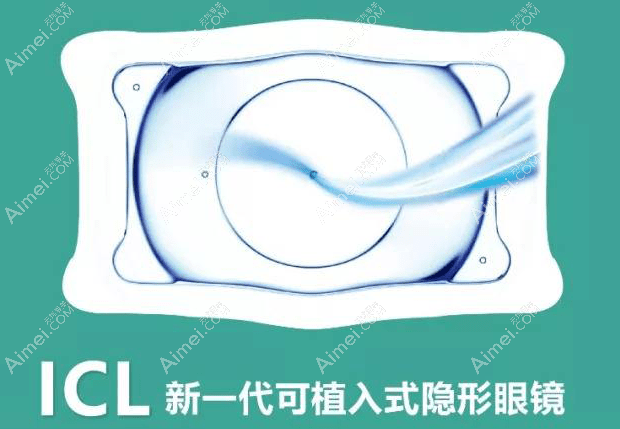 北京爱尔眼科icl手术流程