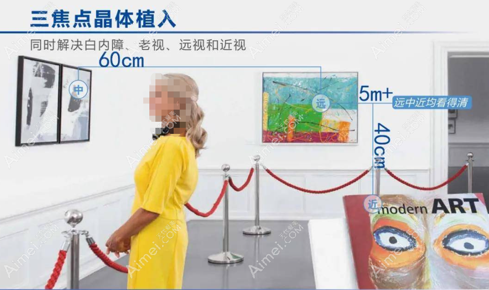 三焦点人工晶体远中近都看得清