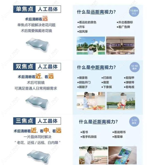 三焦点人工晶体植入后真实感受