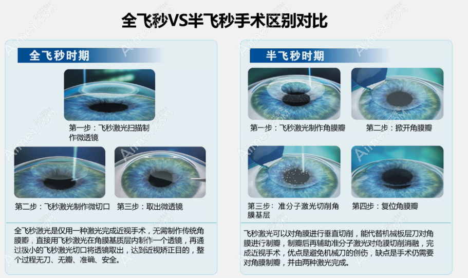 全飞秒和半飞秒区别图片
