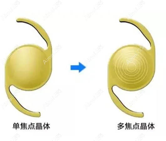 美国眼力健zmboo多焦人工晶体价格aimei.com