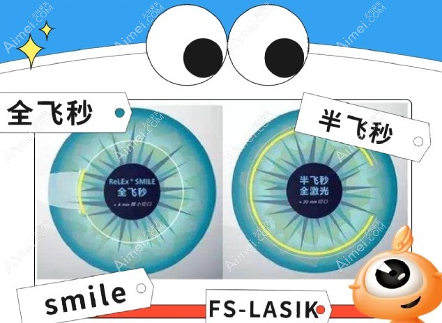全飞秒、半飞秒和个性化半飞秒激光近视手术哪个好爱美网