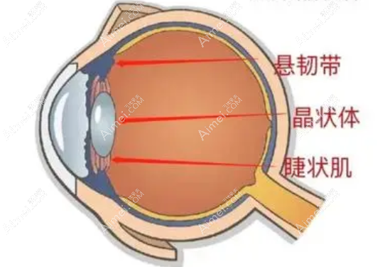 单焦点人工晶体品牌推荐