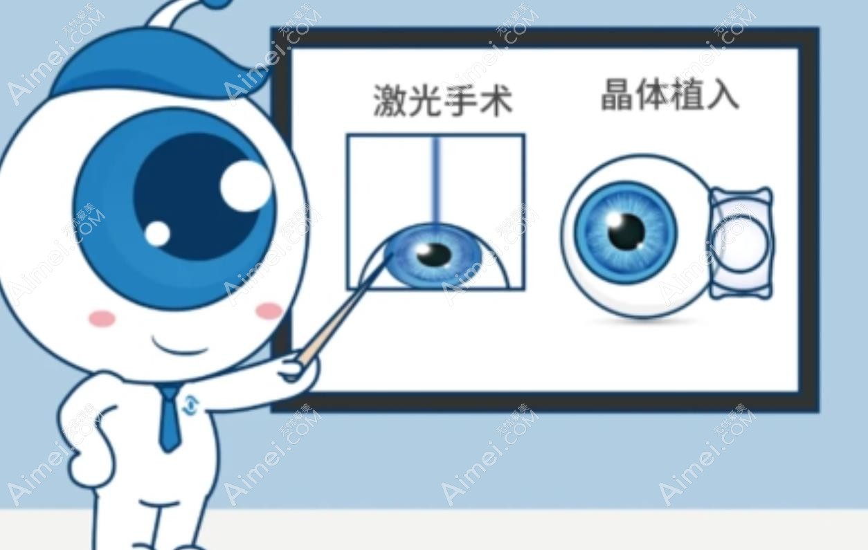 近视手术类型