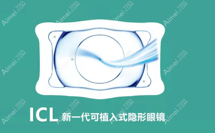 icl晶体2025价目表:基础款icl-V4c价格15800起;散光款ticl-V4c18800起