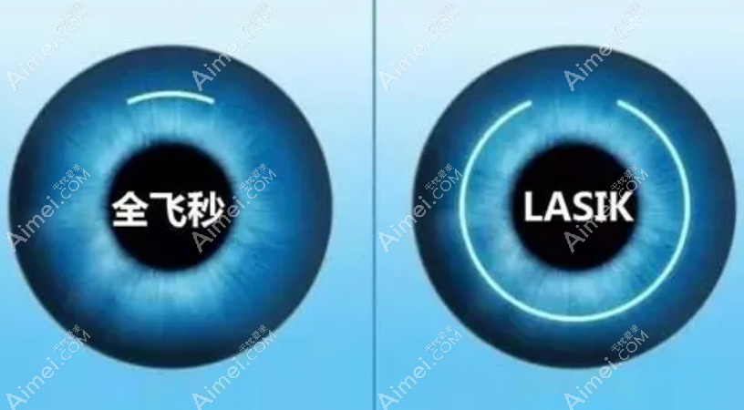 常州近视眼300/600/1000度手术费用8000起800元