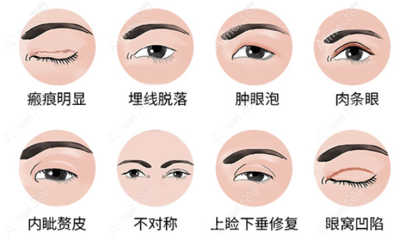 南京做双眼皮修复手术好的医生排名:前十有王小林和黄名斗