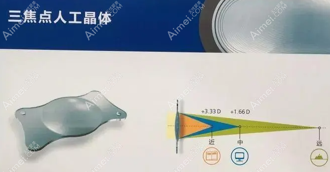 北京白内障三焦点人工晶体植入手术价格多少钱