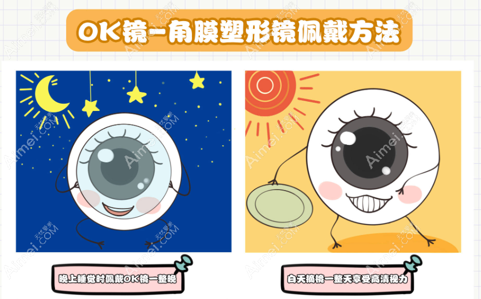 深圳角膜塑形镜价格4000元起一副