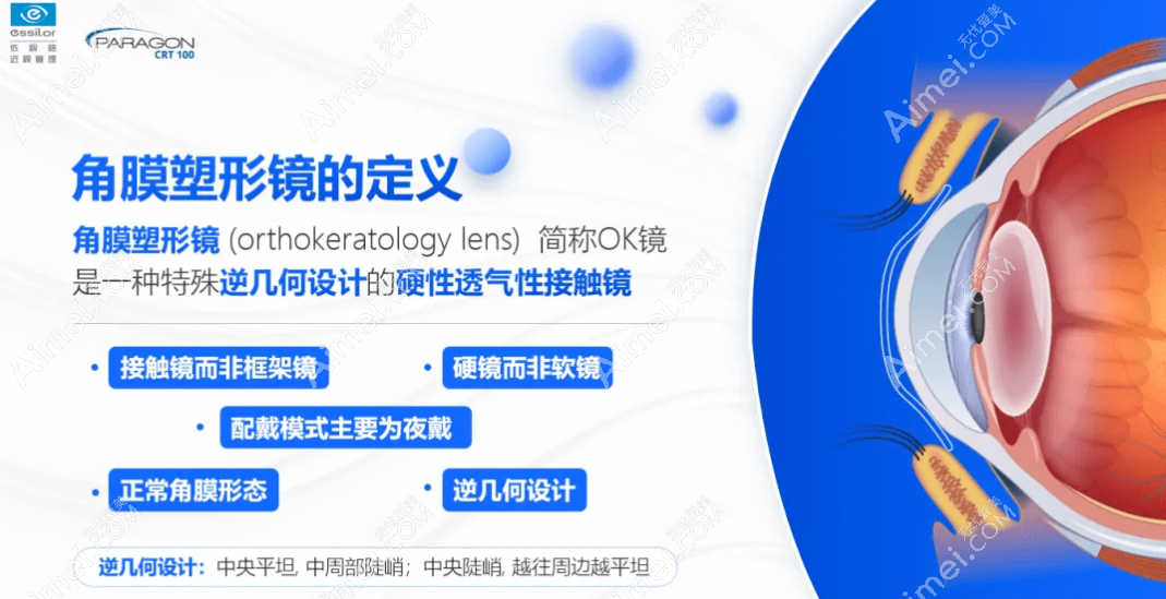 深圳角膜塑形镜价格