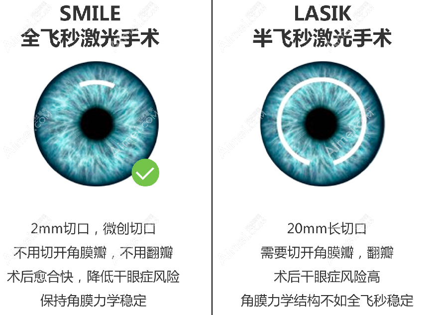 李海燕医生做激光近视手术经验多