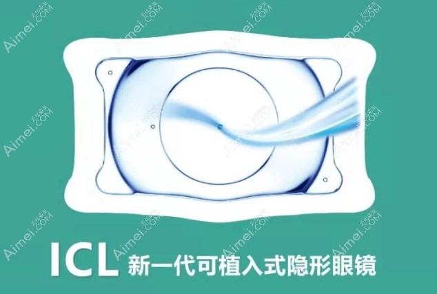 青岛ICL晶体植入价格不贵,30000元起检查免费做但不能报销