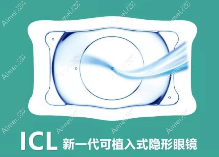 成都icl晶体植入手术价格公布:icl带散光3.38w/icl不加散光2.68w+