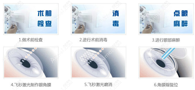 重慶何氏眼科醫(yī)院激光近視手術(shù)多少錢 aimei.com