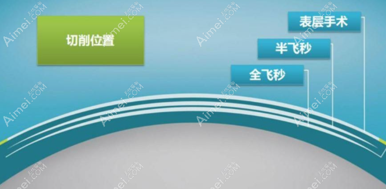 临沂华厦眼科医院矫正近视怎么样