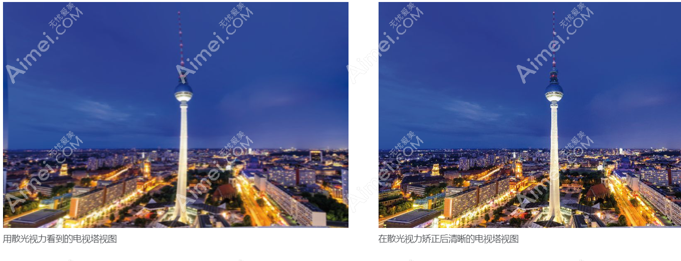 蔡司709人工晶体植入前后视力对比图片 蔡司709人工晶体植入前后视力对比图片