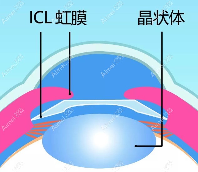 李海燕眼科医生靠谱