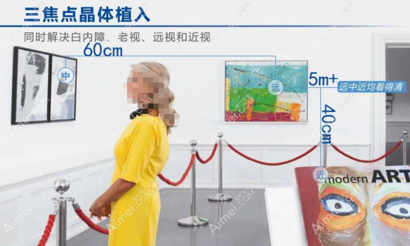 广州希玛眼科医院姚勇白内障手术怎么样
