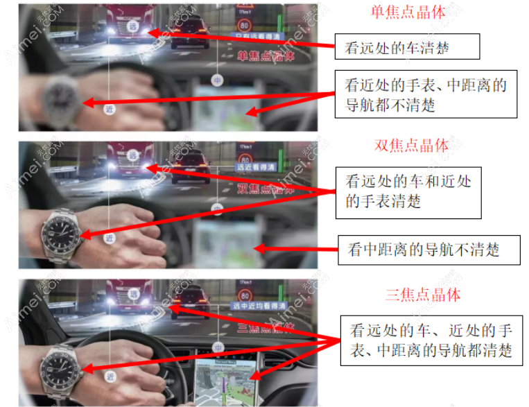 白内障单焦双焦三焦晶体区别