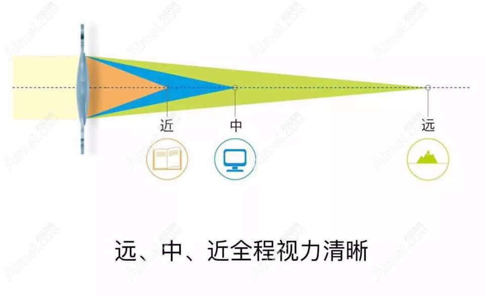 ​白内障三焦晶体植入后真实感受,更换3焦晶体会有哪些变化