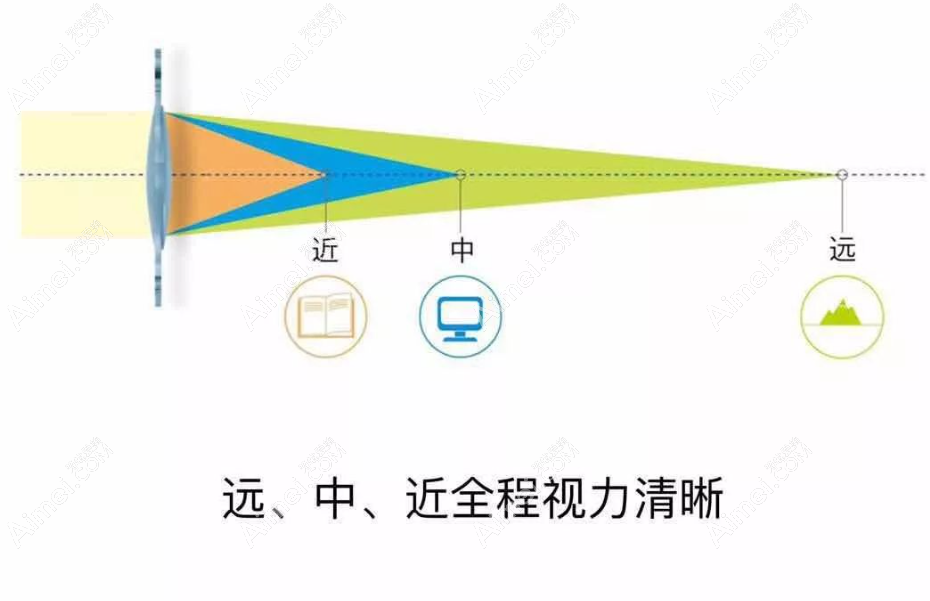 植入三焦晶体看东西模糊不清