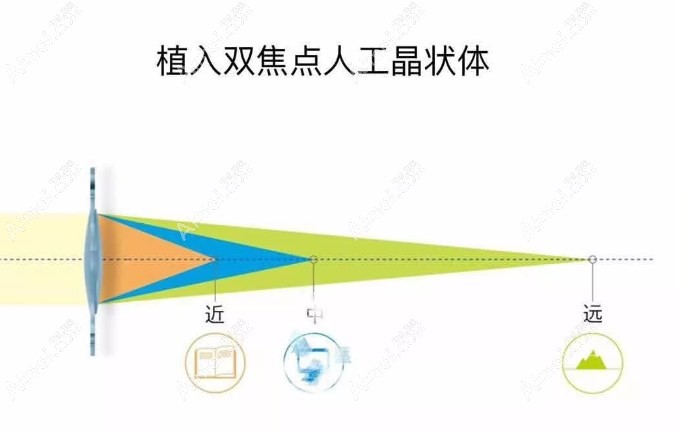 蔡司909m晶体是什么焦aim/ei.com